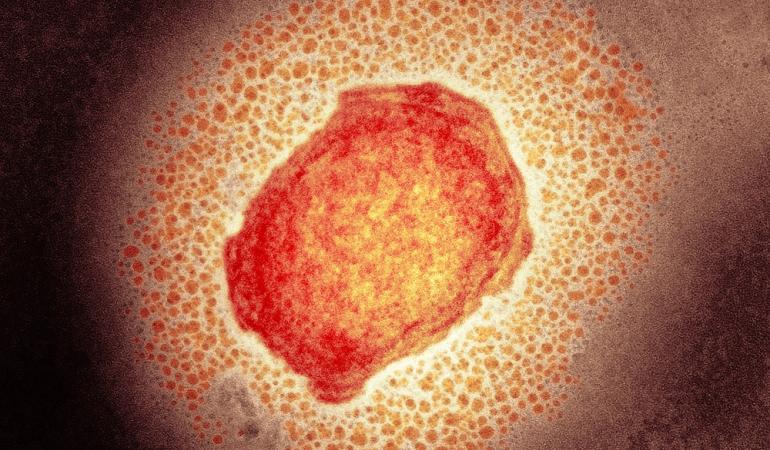monkeypoxvirus-apenpokkenvirus-website-rivm